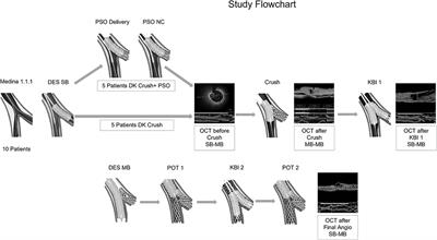 Optical Coherence Tomography to Assess Proximal Side Optimization Technique in Crush Stenting